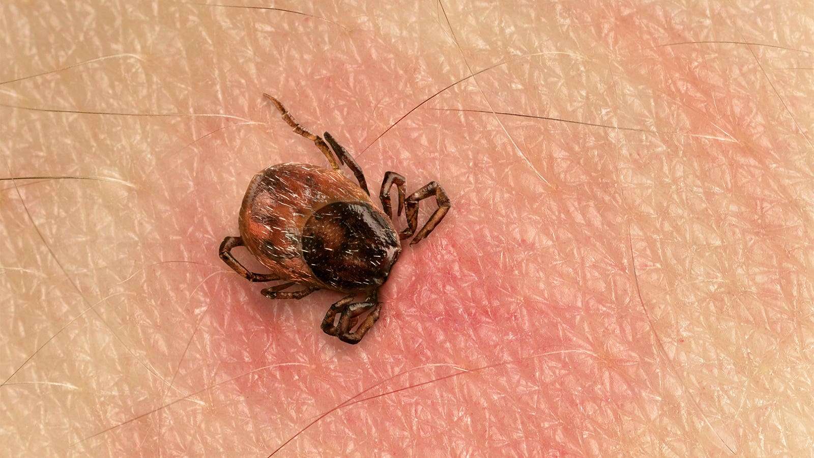 Ticks and Lyme Disease: An Increasing Problem in Recent Years Ticks and Lyme Disease: An Increasing Problem in Recent Years